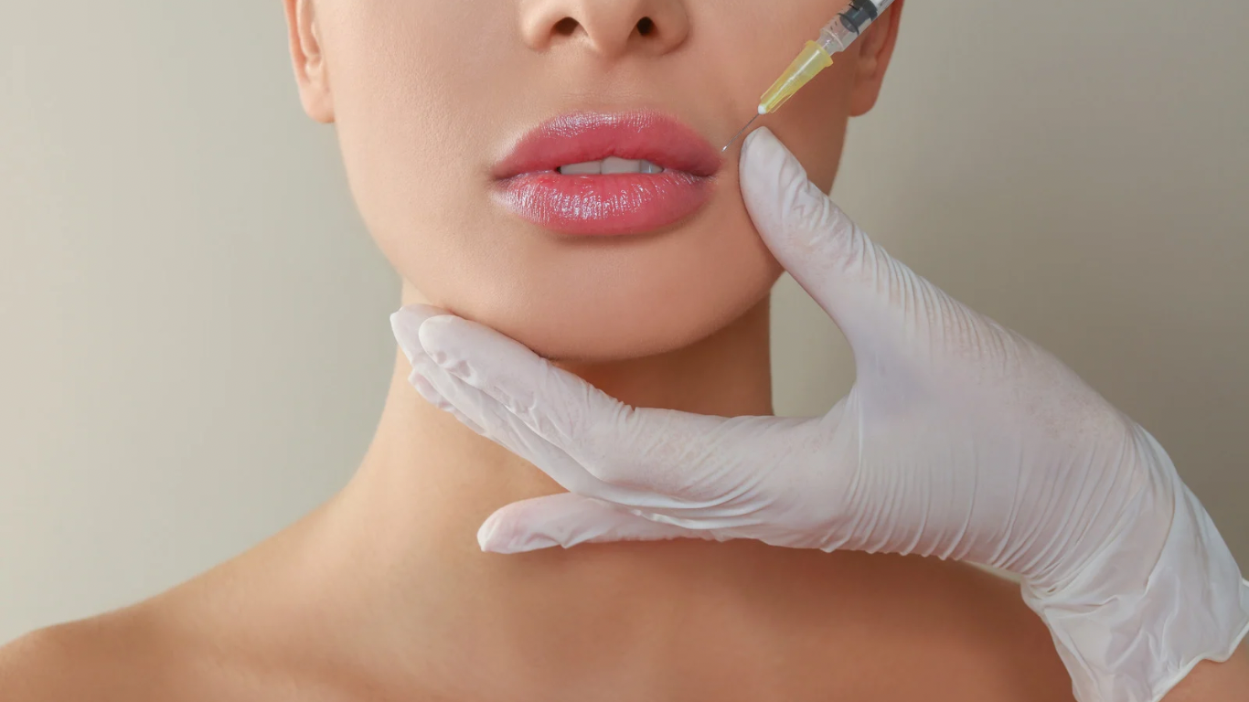 How Long Does It Take to See Full Results from Lip Fillers? Close-up of plump, well-defined lips after a dermal filler treatment, showcasing smooth, natural-looking results. Swelling has settled, revealing the final outcome of the procedure at Elenoire Aesthetics in Birmingham