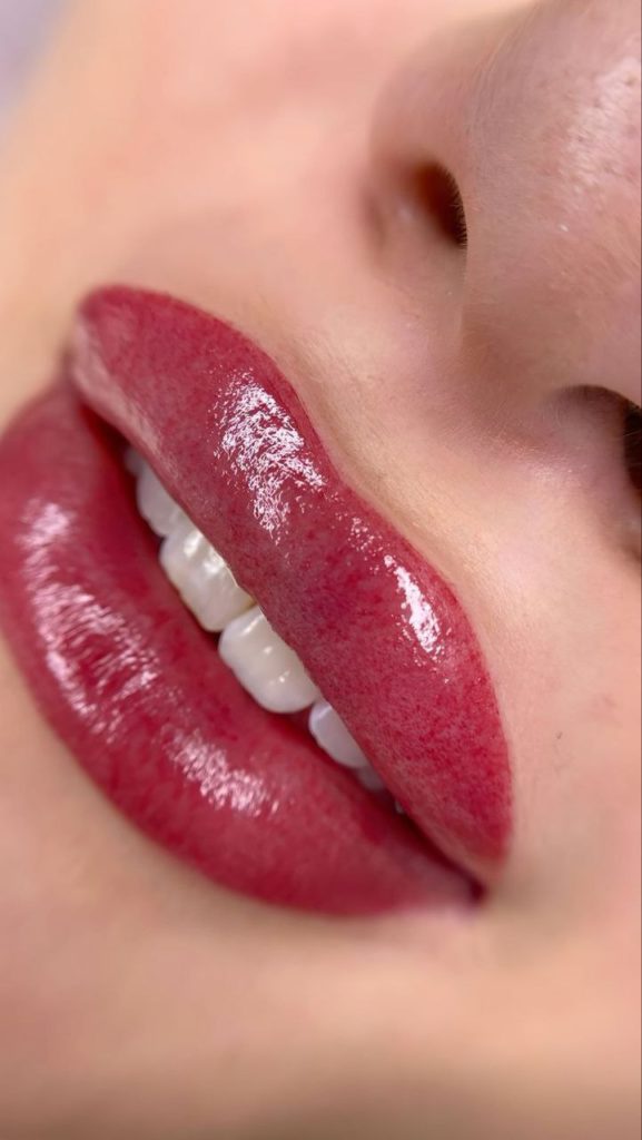 Lip blush micropigmentation treatment